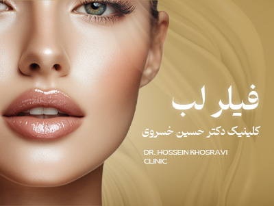 فیلر لب